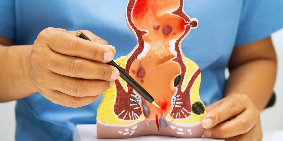 proctologista